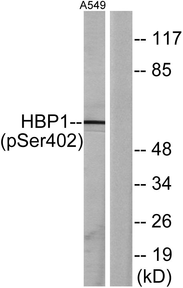 Western blot analysis of lysates from A549 cells treated with PMA 125ng/ml 30