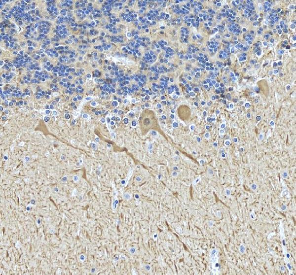a03047 calb1 primary antibodies ihc testing 5