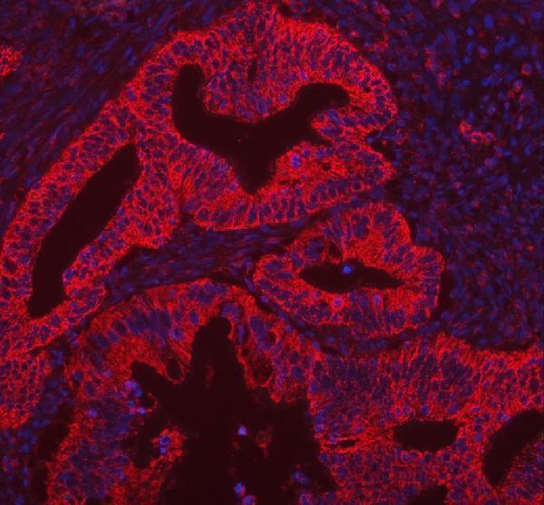 a03048 camkk2 primary antibodies if testing 7