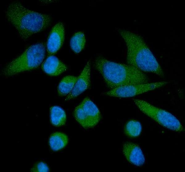 a03048 camkk2 primary antibodies if testing 8