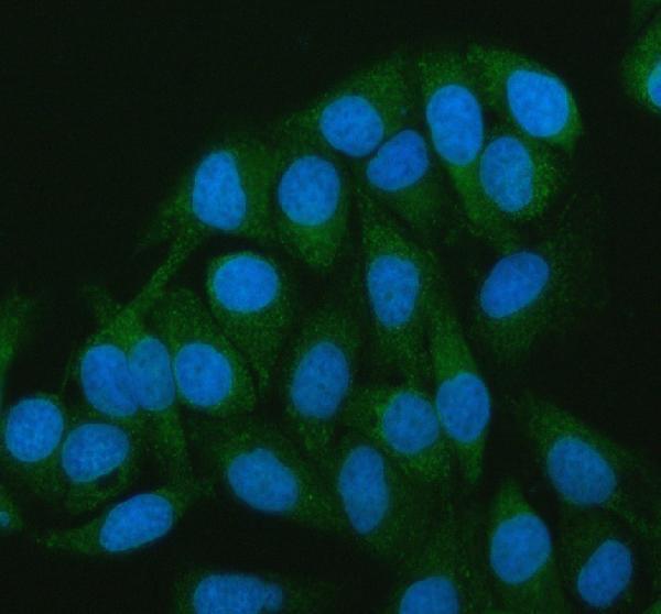 a03048 camkk2 primary antibodies if testing 9