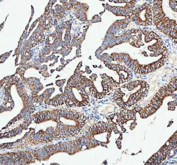  IHC analysis of CAMKK2 using anti-CAMKK2 antibody (A03048)