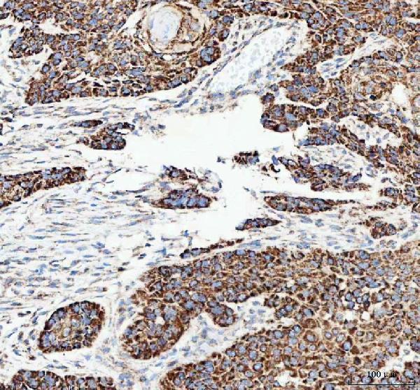  IHC analysis of CAMKK2 using anti-CAMKK2 antibody (A03048)