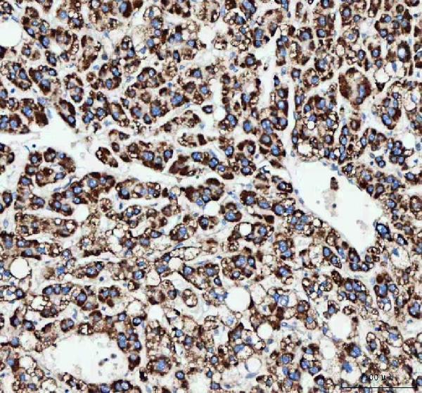 a03048 camkk2 primary antibodies ihc testing 4