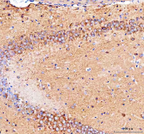 a03048 camkk2 primary antibodies ihc testing 5