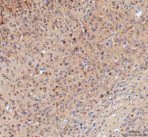 a03048 camkk2 primary antibodies ihc testing 6