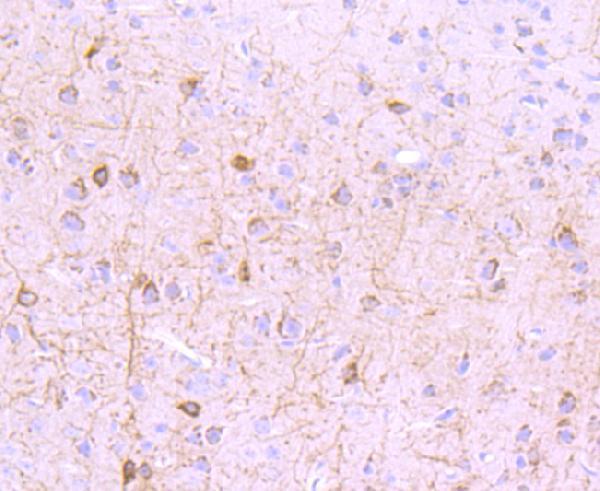 a03049 3 grm1 primary antiboties ihc testing 2