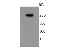 a03049 3 grm1 primary antiboties wb testing 1