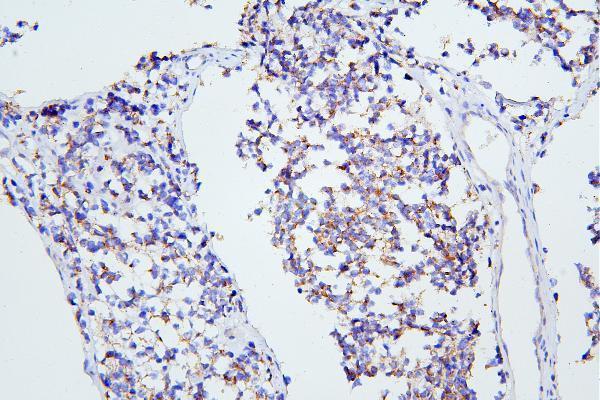 a03049 4 grm1 primary antibodies ihc testing 2