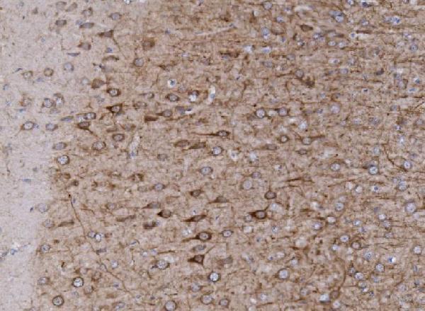 a03049 4 grm1 primary antibodies ihc testing 6