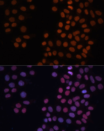 Immunofluorescence analysis of HeLa cells using HMGN1 antibody  at dilution of 1:100