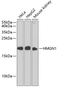 Western blot analysis of extracts of various cell lines, using HMGN1 antibody  at 1:1000 dilution