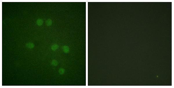 Immunofluorescence analysis of HepG2 cells, using HMG14 Antibody