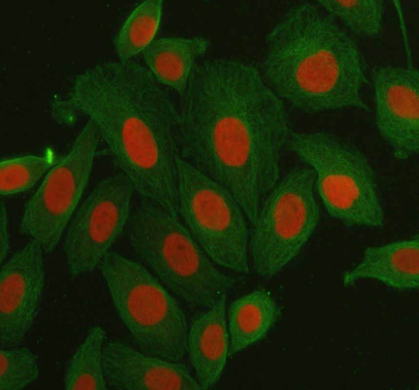 a03051 3 hmgn1 primary antibodies if testing 1