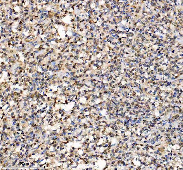 IHC analysis of HMGN1 using anti-HMGN1 antibody (A03051-3)