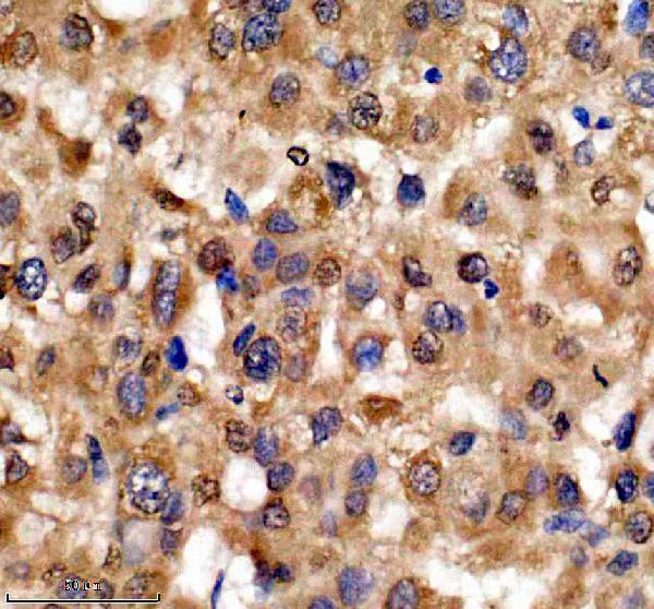 IHC analysis of HMGN1 using anti-HMGN1 antibody (A03051-3)