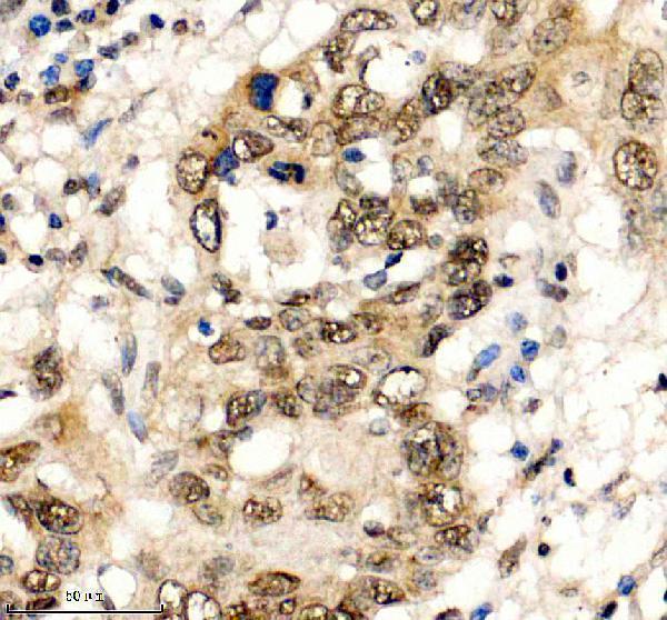 a03051 3 hmgn1 primary antibodies ihc testing 3