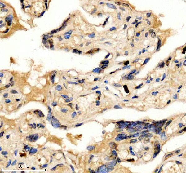 a03051 3 hmgn1 primary antibodies ihc testing 4