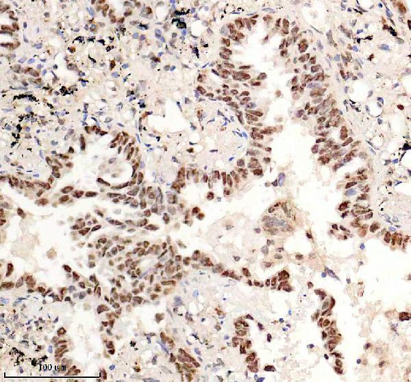 a03051 3 hmgn1 primary antibodies ihc testing 5