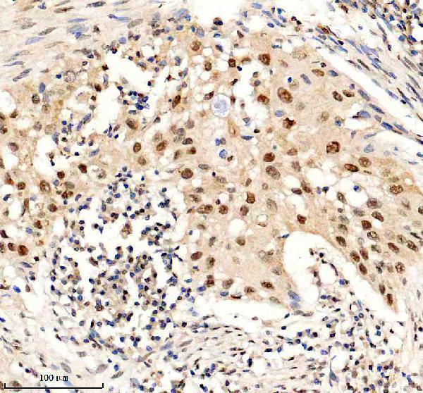 a03051 3 hmgn1 primary antibodies ihc testing 6