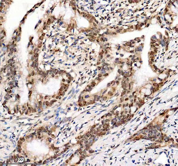 a03051 3 hmgn1 primary antibodies ihc testing 7