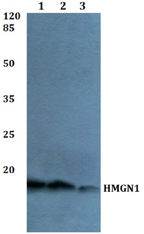 Western blot (WB) analysis of HMGN1 polyclonal antibody at 1:500 dilution
Lane1:Hela whole cell lysate
Lane2:NIH-3T3 whole cell lysate
Lane3:H9C2 whole cell lysate