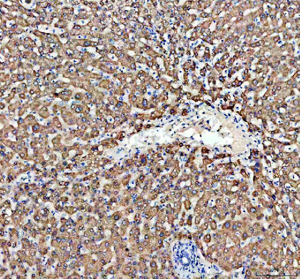 a03054 1 acox1 primary antibodies ihc testing 1