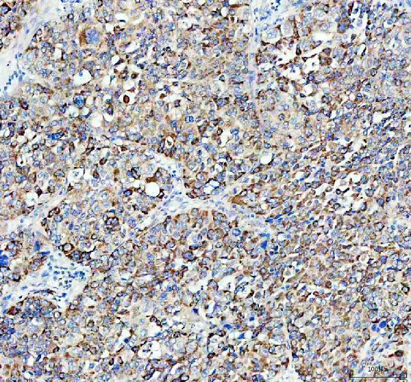 a03054 1 acox1 primary antibodies ihc testing 2