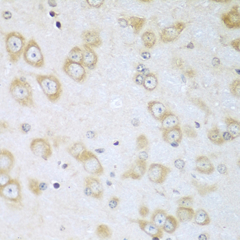 a03054 acox1 primary antiboties ihc testing 2