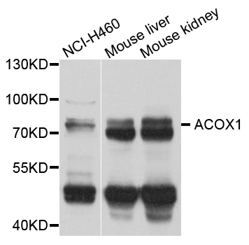 a03054 acox1 primary antiboties wb testing 1
