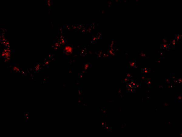 a03055 1 rrm2b primary antibodies if testing 3
