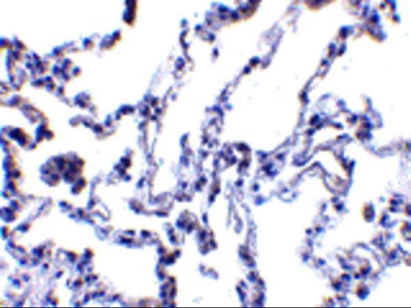 a03055 1 rrm2b primary antibodies ihc testing 2