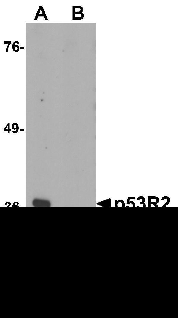 a03055 1 rrm2b primary antibodies wb testing 1