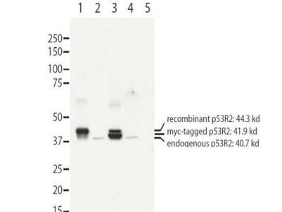 a03055 rrm2b primary antibodies wb testing 1