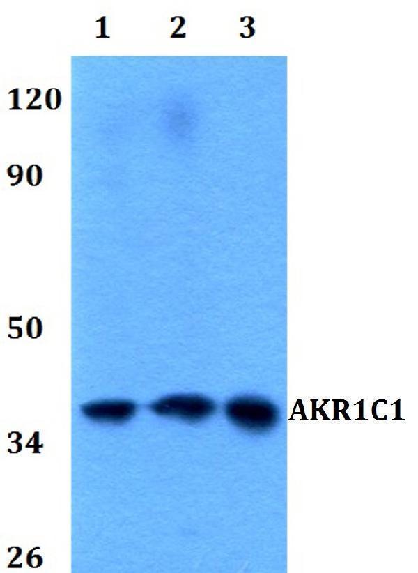 a03056 1 akr1c1 primary antiboties wb testing 1