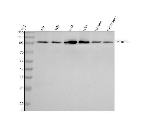  Western blot analysis of iASPP/PPP1R13L using anti-iASPP/PPP1R13L antibody (A03058-2)