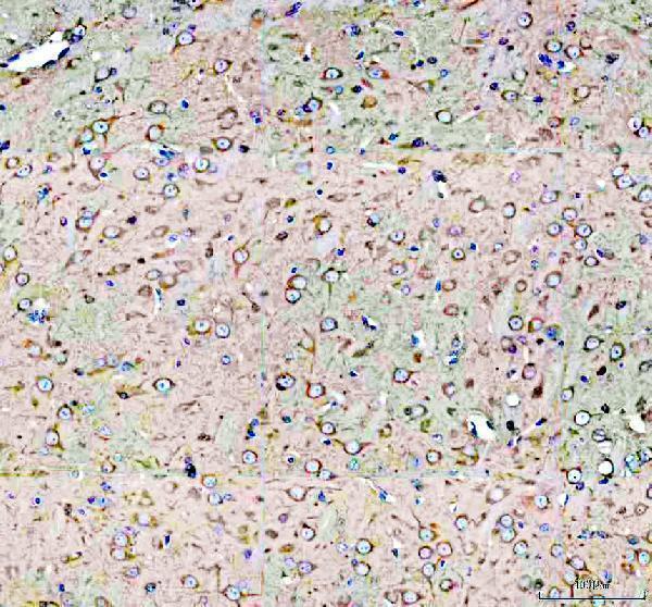 IHC analysis of DYNC1H1 using anti-DYNC1H1 antibody (A03059-2)
