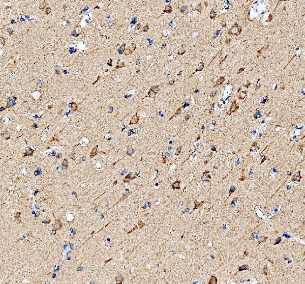 IHC analysis of DYNC1H1 using anti-DYNC1H1 antibody (A03059-2)