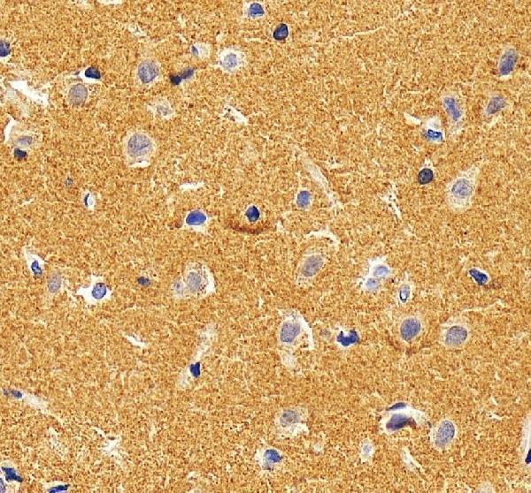 IHC analysis of CAPON/NOS1AP using anti-CAPON/NOS1AP antibody (A03060-3)