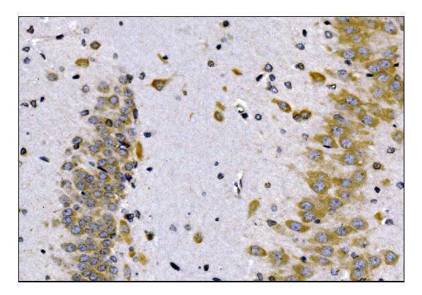  IHC analysis of SCN1B using anti-SCN1B antibody (A03061-1)