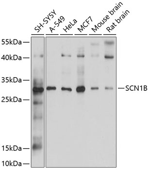 Western blot analysis of extracts of various cell lines, using SCN1B antibody  at 1:1000 dilution