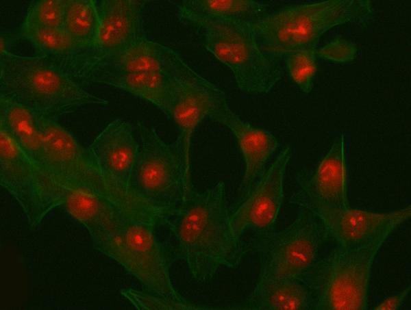 a03065 1 phf6 primary antibodies if testing 15
