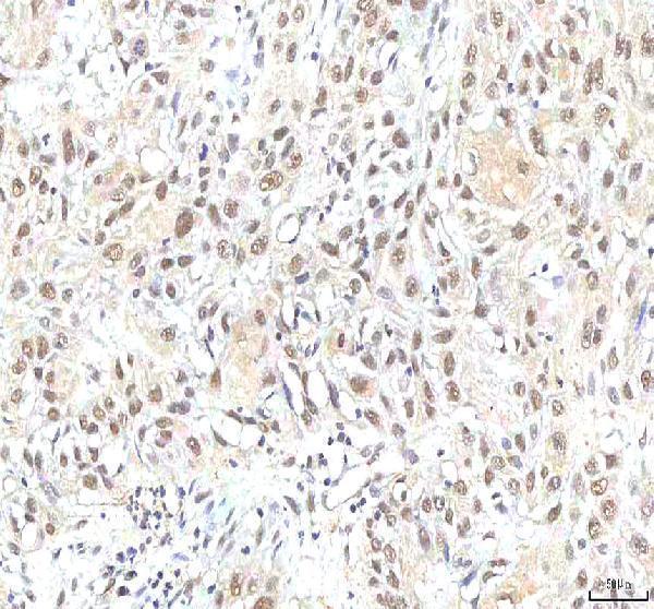 a03065 1 phf6 primary antibodies ihc testing 10