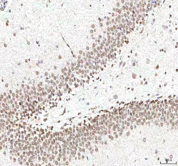 a03065 1 phf6 primary antibodies ihc testing 11