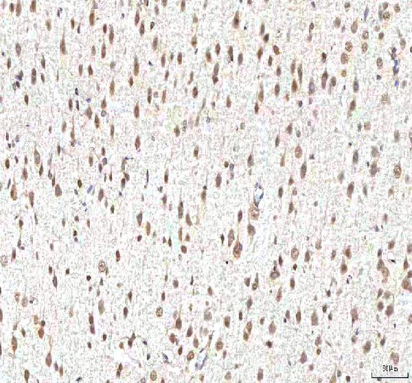 a03065 1 phf6 primary antibodies ihc testing 12