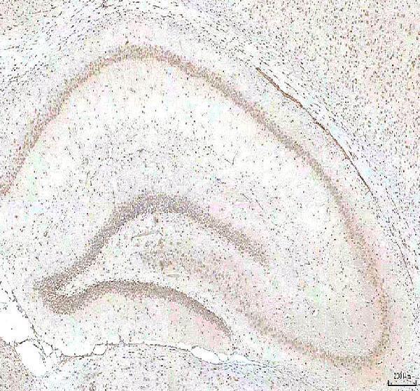 a03065 1 phf6 primary antibodies ihc testing 13