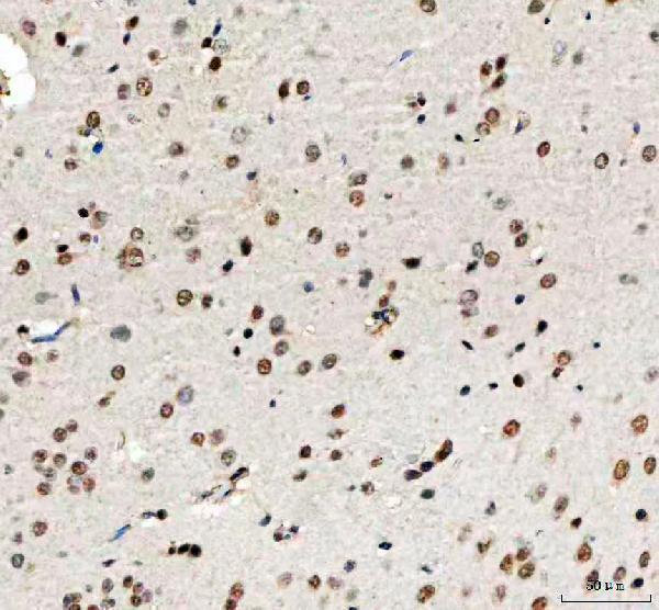 a03065 1 phf6 primary antibodies ihc testing 14
