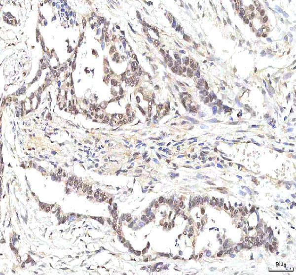  IHC analysis of PHF6 using anti-PHF6 antibody (A03065-1)