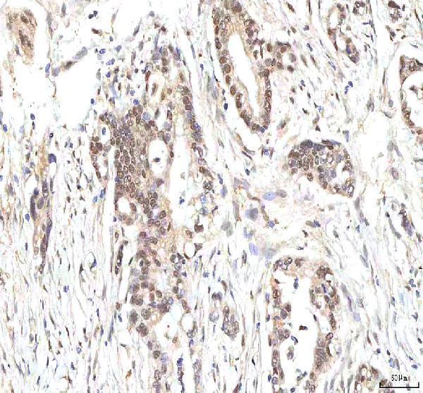  IHC analysis of PHF6 using anti-PHF6 antibody (A03065-1)