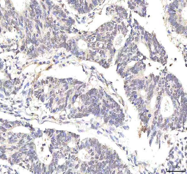 a03065 1 phf6 primary antibodies ihc testing 4